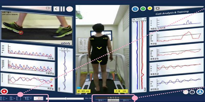 척추측만증_무료검진2