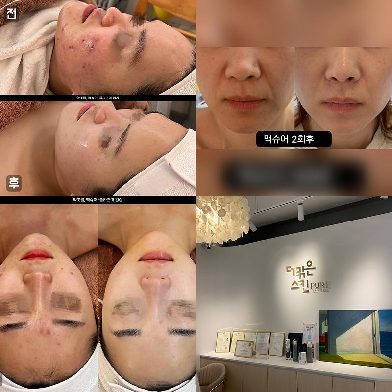 더맑은스킨 강화점 사진5